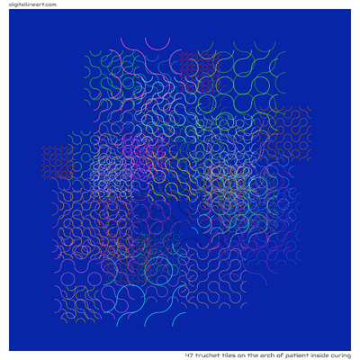 The Arch of Patient Inside Curing — 47 Truchet tiles